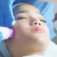 Thermage FLX, Teknologi Canggih untuk Kulit Awet Muda Tanpa Operasi. dok.  idsMED Aesthetics Indonesia