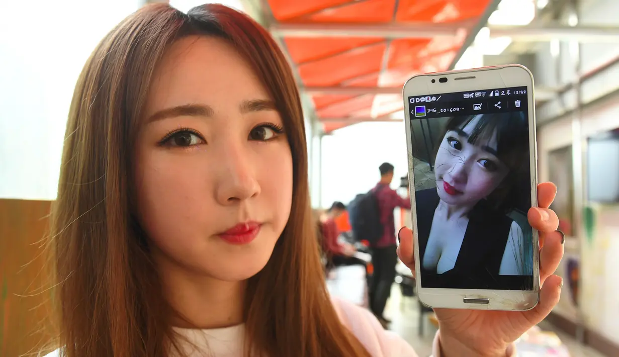 Personel girlband Six Bomb, Lee So-Young atau Seul-Bee, menunjukkan foto dirinya sebelum menjalani operasi plastik di sebuah salon kecantikan di Seoul, Korsel, 16 Maret 2017. Seul-Bee menjalani operasi plastik pada bagian hidungnya. (YELIM LEE/AFP)