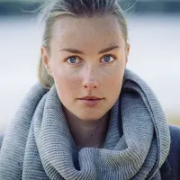 Flek hitam mengganggu penampilan? Atasi dengan cara alami berikut ini. (Foto: Unsplash)