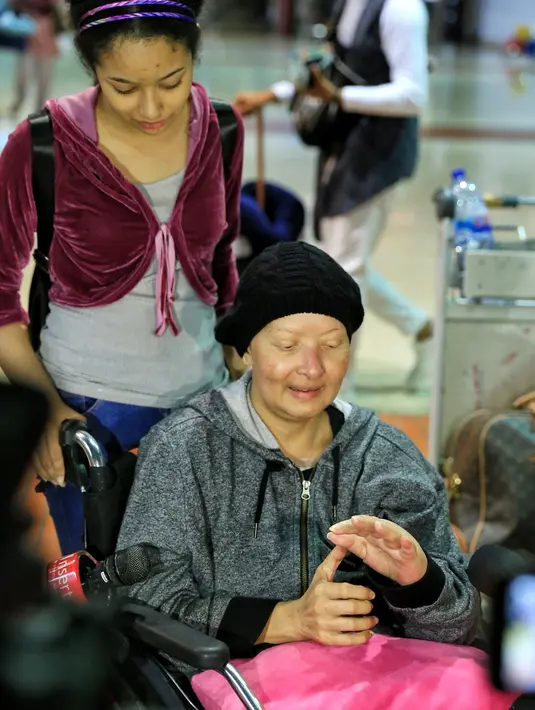 Pengobatan yang akan dijalani Yana di Cina ini merupakan tawaran yang didapatkannya dari dua ahli medis berasal dari Cina yang sengaja datang langsung ke Indonesia dan mengajaknya untuk berobat disana. (Adrian Putra/Bintang.com)