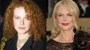 Dilansir dari HollywoodLife, Nicole Kidman mengaku bahwa dirinya pernah melakukan Botox. Namun ia sudah melepaskannya sekarang. (Rex/Shutterstock/HollywoodLife)