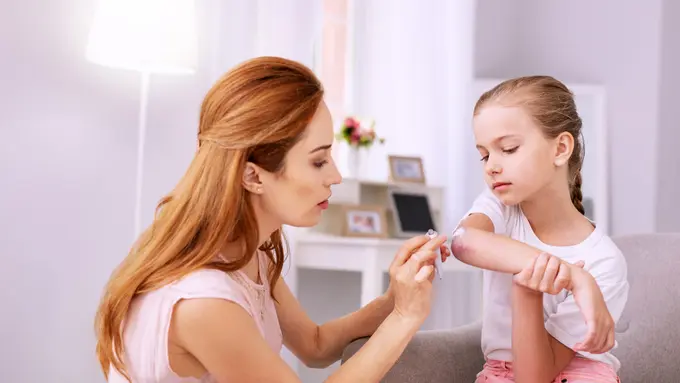 ilustrasi luka bakar