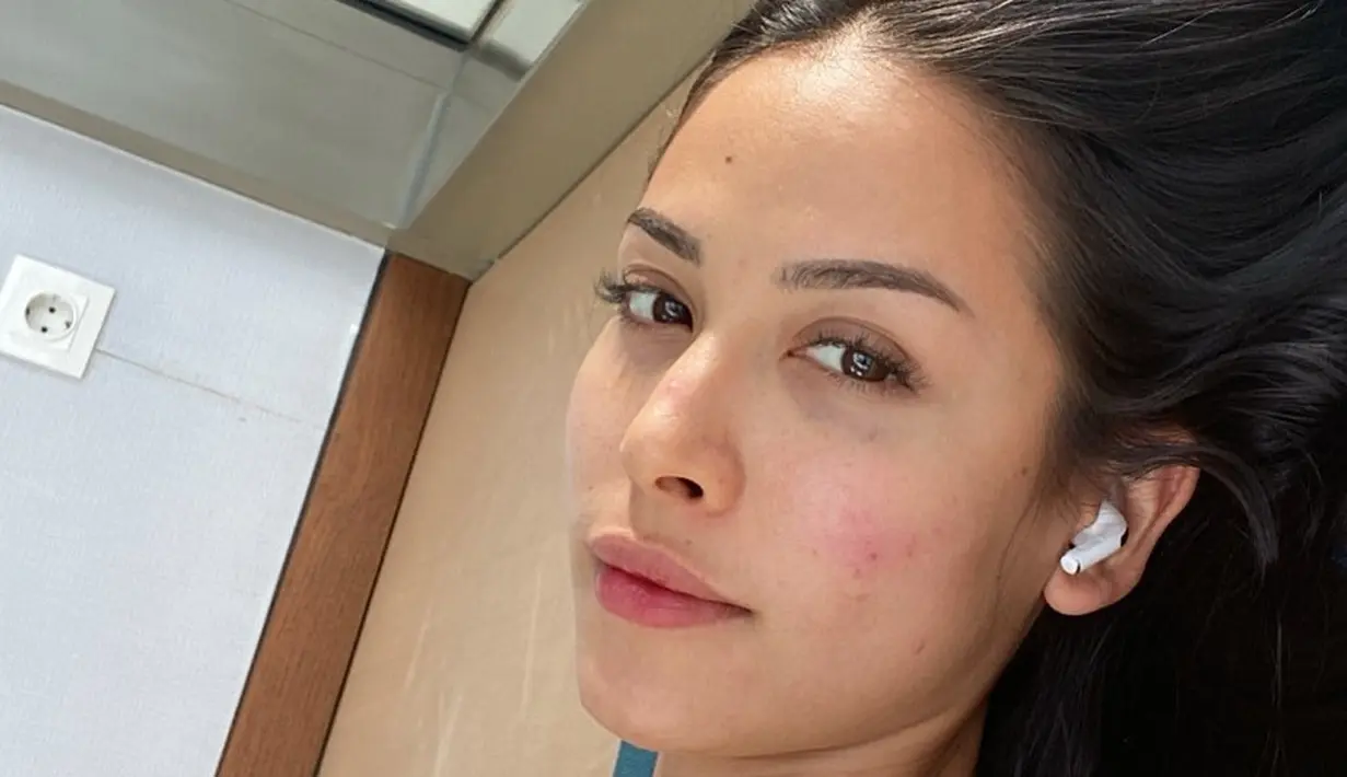 Inilah potret Estelle Linden yang terlihat pede memamerkan wajah dengan jerawat di pipi. Wanita 26 tahun ini tetap cantik meski tanpa polesan makeup. (Liputan6.com/IG/@estelleelinden).