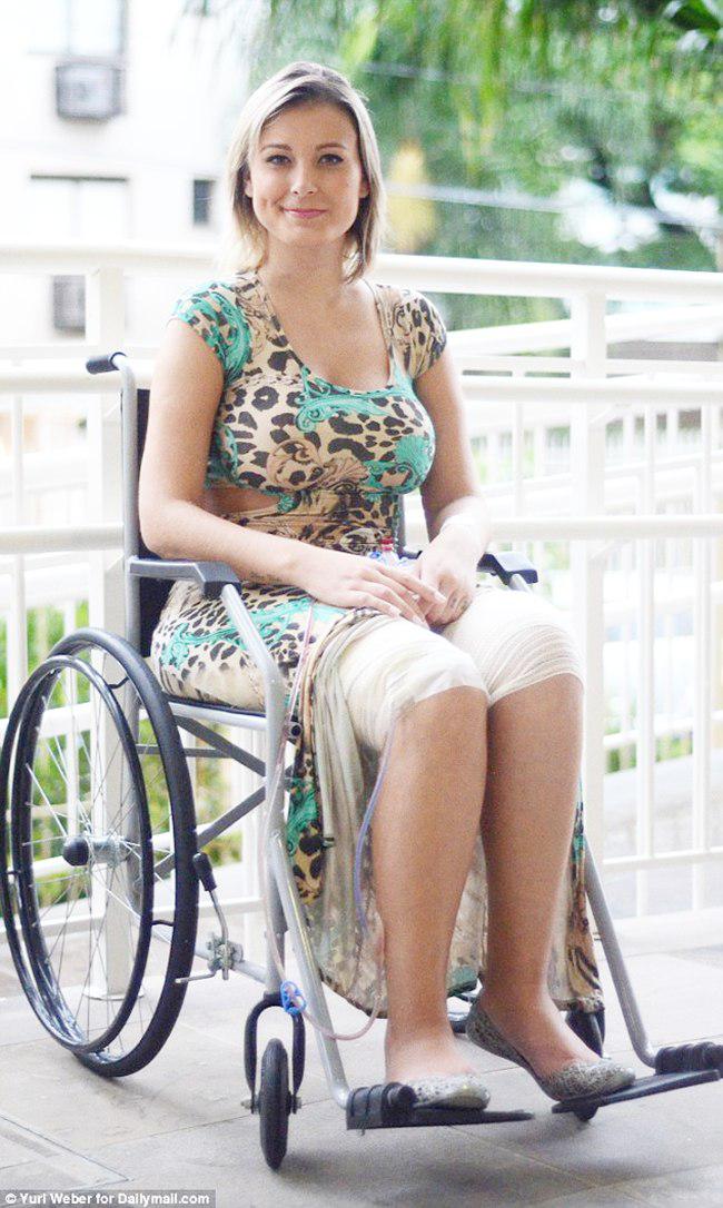 Andressa saat ini menjalani perawatan intensif di rumah sakit Sao Paulo, Brasil | foto: copyright dailymail.co.uk