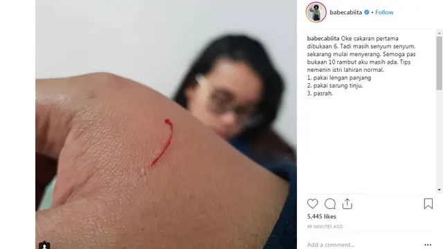 Babe Cabita (Foto: Instagram)
