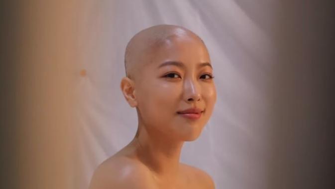 Karena kanker getah bening yang dideritanya, Dawn Lee terpaksa membotaki kepalanya. (dok. Youtube Secret Dawn/Dinny Mutiah)