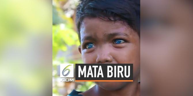 VIDEO: Dikira Sakit, Bocah ini Punya Mata Warna Biru