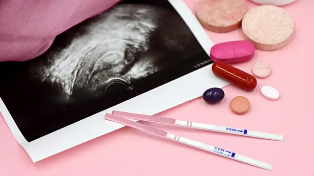 Resiko yang perlu diwaspadai dari kanker ovarium