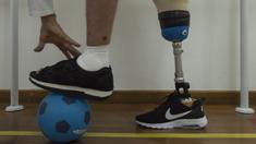 Kiper Chapecoense, Jakson Follmann, menjalani terapi pengobatan pada sebuah klinik di Sao Paulo, Brasil, Kamis (23/2/2017). Dirinya merupakan satu dari enam korban yang selamat saat tragedi pesawat jatuh di Kolombia. (AFP/Nelson Almeida)