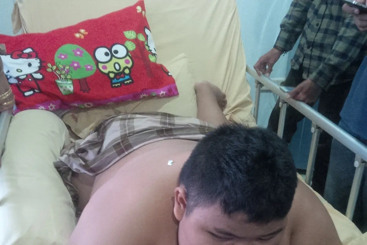 Obesitas, Palembang