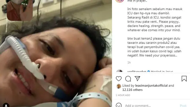 Suami Joanna Alexandra kritis karena Covid -19