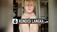 AKSI PRIA MAMPU MENYATUKAN BAHUNYA, KOK BISA?