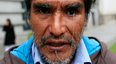 Edwin Morales, salah satu pemimpin demonstrasi berpose dengan mata palsunya di La Paz, Bolivia (12/4). Edwin merupakan satu dari ratusan penyandang cacat di Bolivia yang menuntut Presiden Bolivia Evo Morales. (REUTERS/David Mercado)