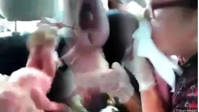 [Bintang] Bidan Imelda Selamatkan Bayi yang Lahir Tak Bernapas