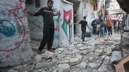 Puluhan warga Palestina menderita luka parah akibat peluru tajam akibat serangan militer Israel tersebut. (AFP/Zain Jaafar)