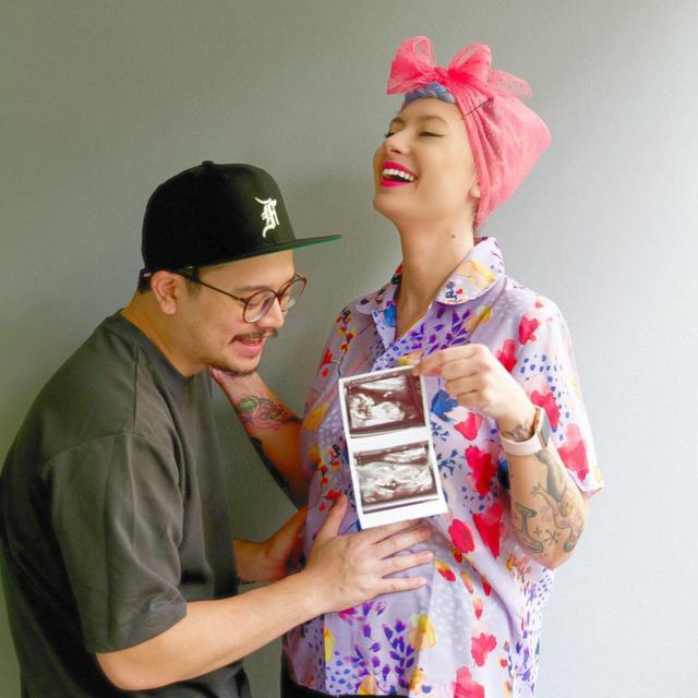 6 Potret Derby Romero Jadi Suami Siaga, Siap Sambut Kelahiran Anak Perempuan