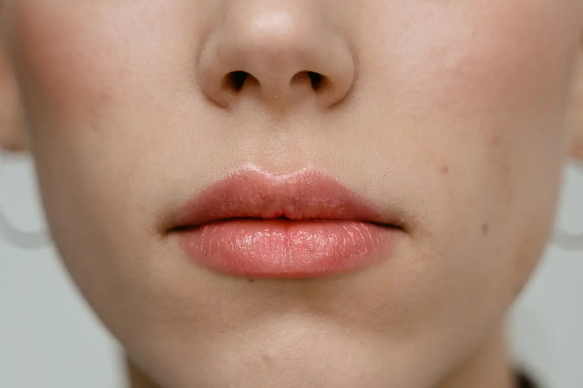 Bibir Menipis