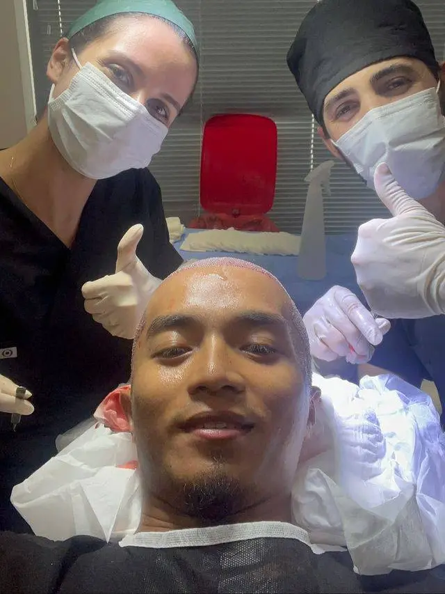 7 Potret Taqy Malik yang Kini Botak Usai Tanam Rambut di Turki