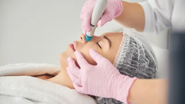 komedo hitam menumpuk