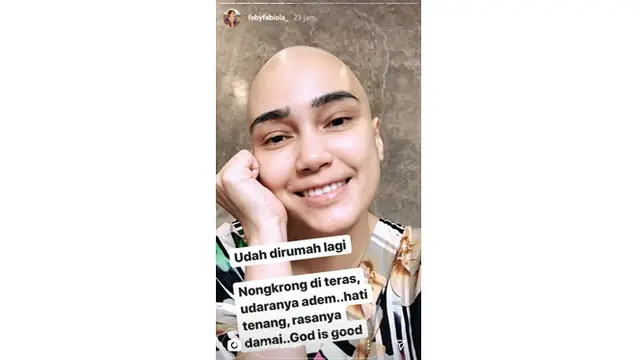 Sudah Jalani Kemoterapi Kedua, Ini 6 Potret Terbaru Feby Febiola