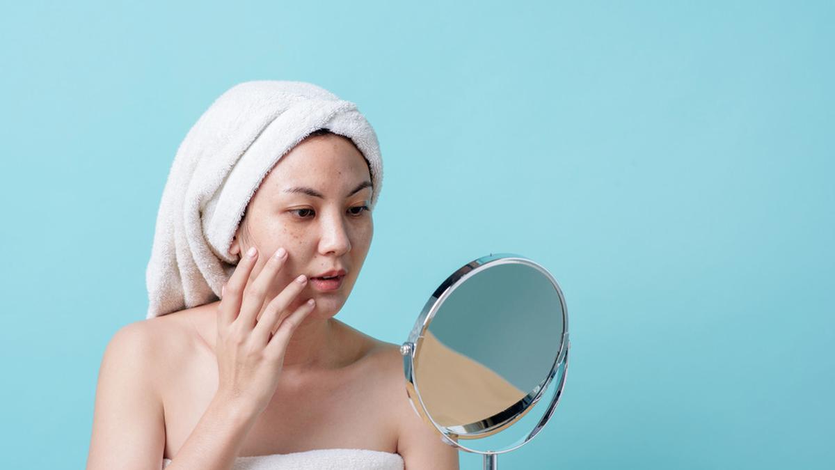 Skincare Wajah Hiperpigmentasi untuk Usia 30-an, Cek Perawatan Penting yang Nggak Boleh Dilewatkan