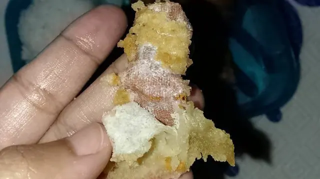 Viral Temuan Plester Bekas dalam Menu MBG di SD Sukabumi. (istimewa)