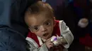 Seorang ibu menggendong bayinya saat menjalani perawatan di bangsal gizi buruk RS Anak Nasional Ataturk, Kabul, Afghanistan, 2 Desember 2021. Menurut PBB dari awal November, hampir 24 juta orang di Afghanistan, sekitar 60 persen dari populasi, menderita kelaparan akut. (AP Photo/Petros Giannakouris)