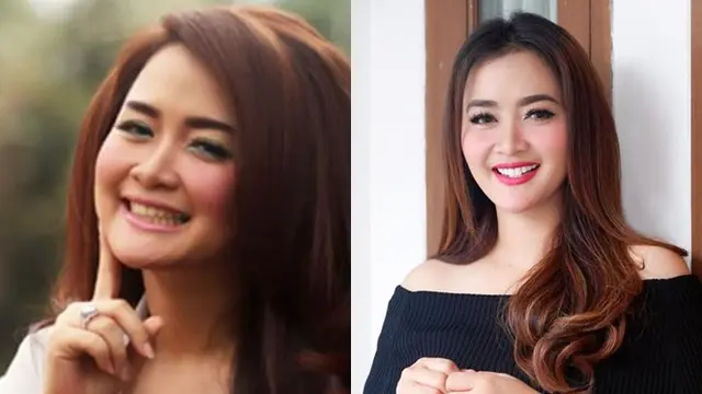 6 Transformasi Seleb Setelah Perbaikan Gigi, Terbaru Elly Sugigi