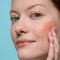 Jangan salah pilih warna blush! Berikut panduannya berdasarkan warna kulit/copyright pexels/Ron Lach