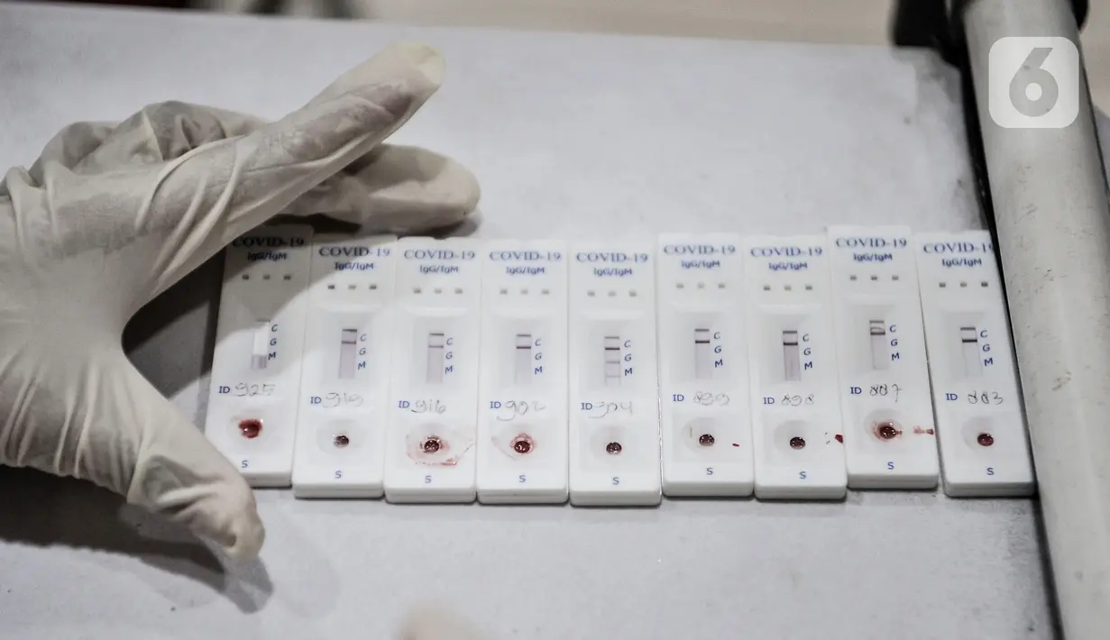 Petugas medis merapikan sampel rapid test calon penumpang di Stasiun Pasar Senen, Jakarta, Senin (26/10/2020). Jumlah penumpang kereta jarak jauh mengalami lonjakan sehingga terjadi antrean panjang rapid test yang menjadi syarat wajib pengguna jasa KAI. (merdeka.com/Iqbal S. Nugroho)