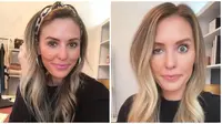 Influencer di Chicago membagikan pengalamannya setelah menjalani botox yang membuat satu kelopak matanya turun. (dok. Instagram @somethingwhitty)