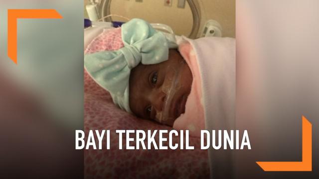 Berita Bayi Terkecil Di Dunia Hari Ini Kabar Terbaru Terkini Liputan6 Com