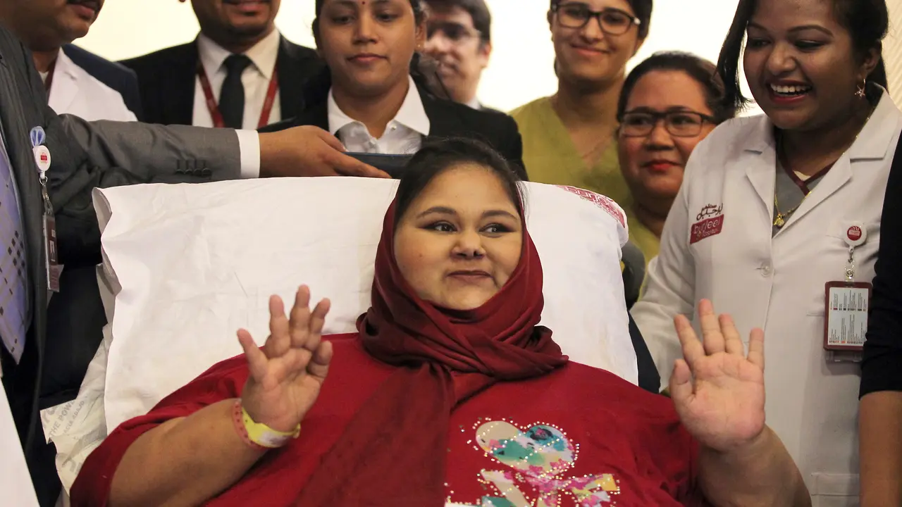 Senyum Bahagia Wanita Terberat di Dunia Usai Operasi 