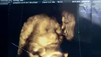 terkejut ketika melihat hasil scan USG 4D, wanita ini tak hanya melihat sosok bayi, melainkan melihat pria mencium bayinya.