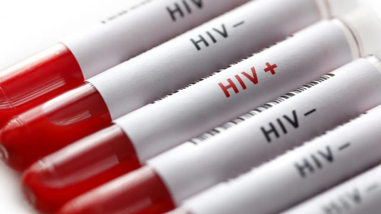 Hampir 80 Ribu Orang di Jakarta Mengidap HIV - News Liputan6.com