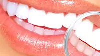 Jarang kontrol ke dokter gigi, malas menggosok gigi, merokok merupakan sebagian dari banyaknya alasan yang membuat gigi nampak kurang cerah.