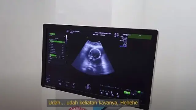 6 Momen Cut Meyriska Periksa Kandungan, Wajah Bayinya Curi Perhatian