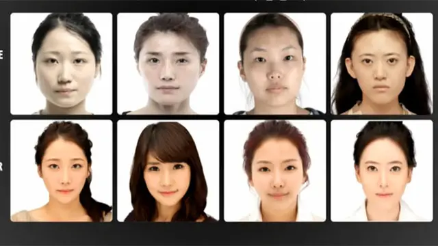 (c) JWplasticsurgeryKOR/youtube.com