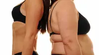 Kini Lebih Banyak Orang Obesitas Dibanding Kurus