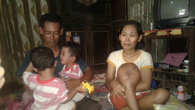 Lutut Kanan Ibu 4 Anak Terus Bengkak Usai Demam Regional