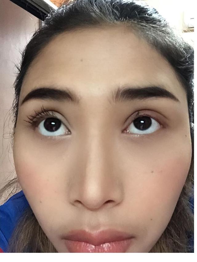 Niat Melentikkan Bulu Mata, Wanita Ini Justru Mengalami Hal Tak Terduga