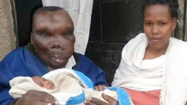 Kisah Cinta Godfrey Baguma, 'The Ugliest Man' di Uganda