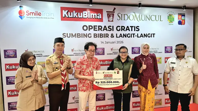 Sido Muncul Kembali Gelar Operasi Gratis Sumbing Bibir, Hadirkan Harapan Baru 50 Anak-Anak di Bogor