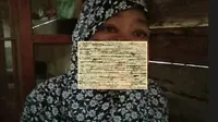 Salmiah (48) warga Dusun Tangkao Indah, Desa Tabolang, Kecamatan Topoyo, Kabupaten Mamuju Tengah, Sulawesi Barat (Sulbar) hanya bisa pasrah dengan penyakit tumor ganas di wajahnya. (Liputan6.com. Abdul Rajab)