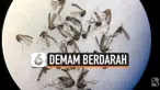 demam berdarah
