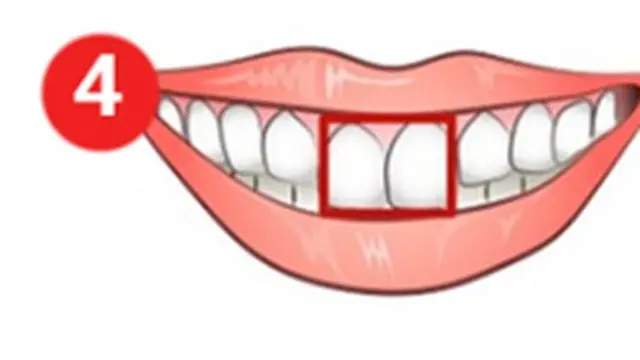 Kepribadian Berdasarkan Bentuk Gigi Persegi