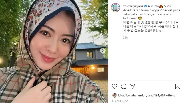 Ayana Jihye Moon (Foto: Instagram/@xolovelyayana)