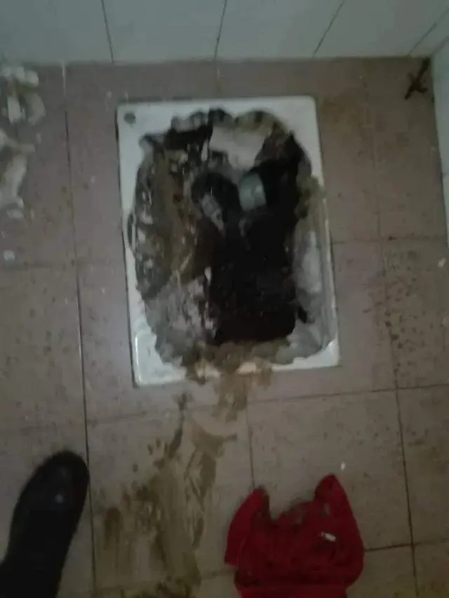 Terpeleset di WC Jongkok, Tubuh Wanita Ini Terperosok Lubang Sampai Sedalam Dada