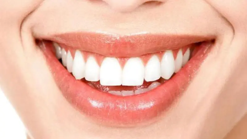 Gigi Putih