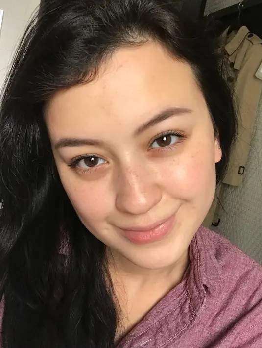 Kimberly Rider memiliki kulit yang putih terang. Tak heran ketuka pakai makeup sering kali muncul bintik-bintik di wajahnya. Ia tak mempermasalahkan adanya freckles di wajah dan lebih memilih syukuri apa yang ada dengan wajah naturalnya. (Liputan6.com/IG/kimberlyryder)